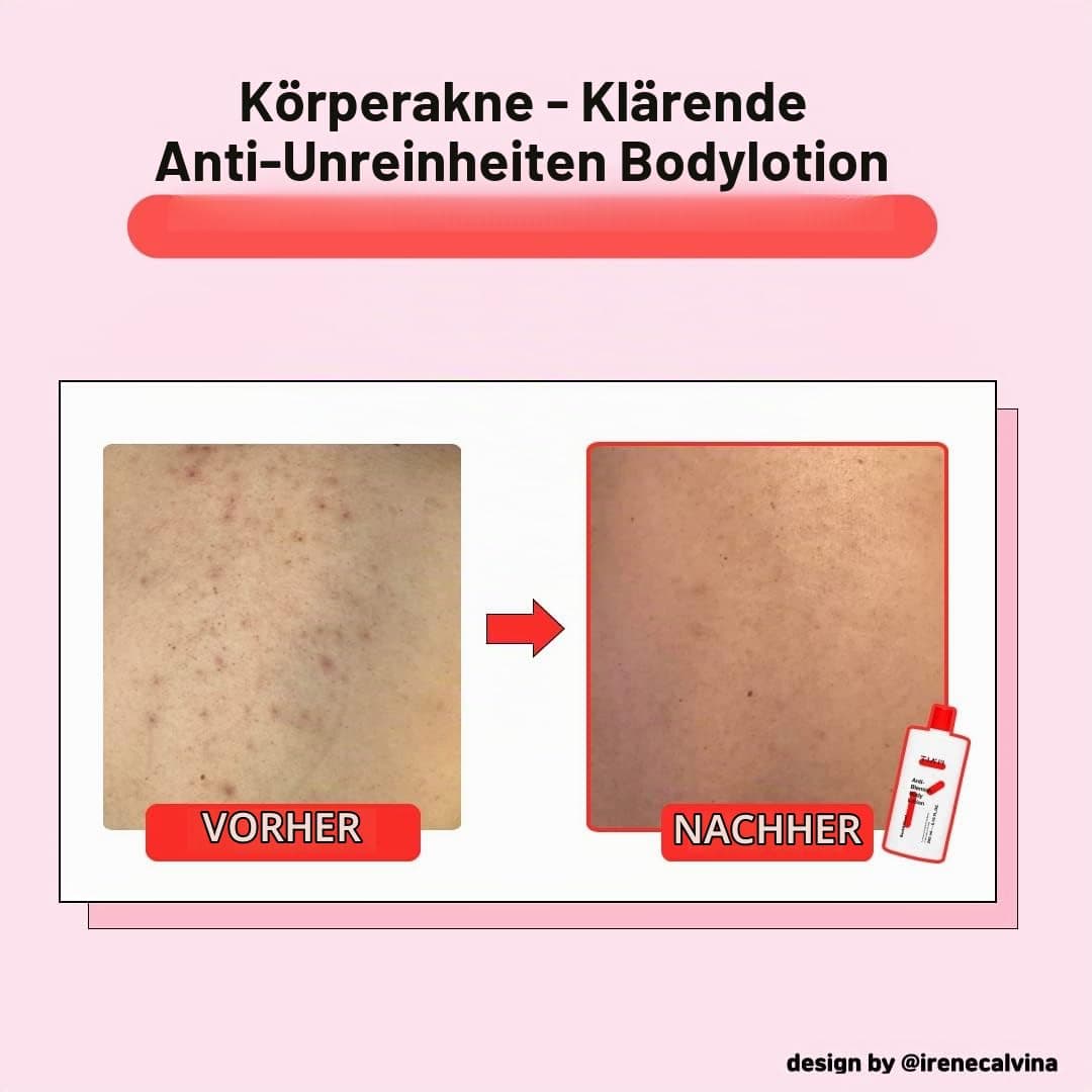 TIA'M Anti-Blemish Body Lotion