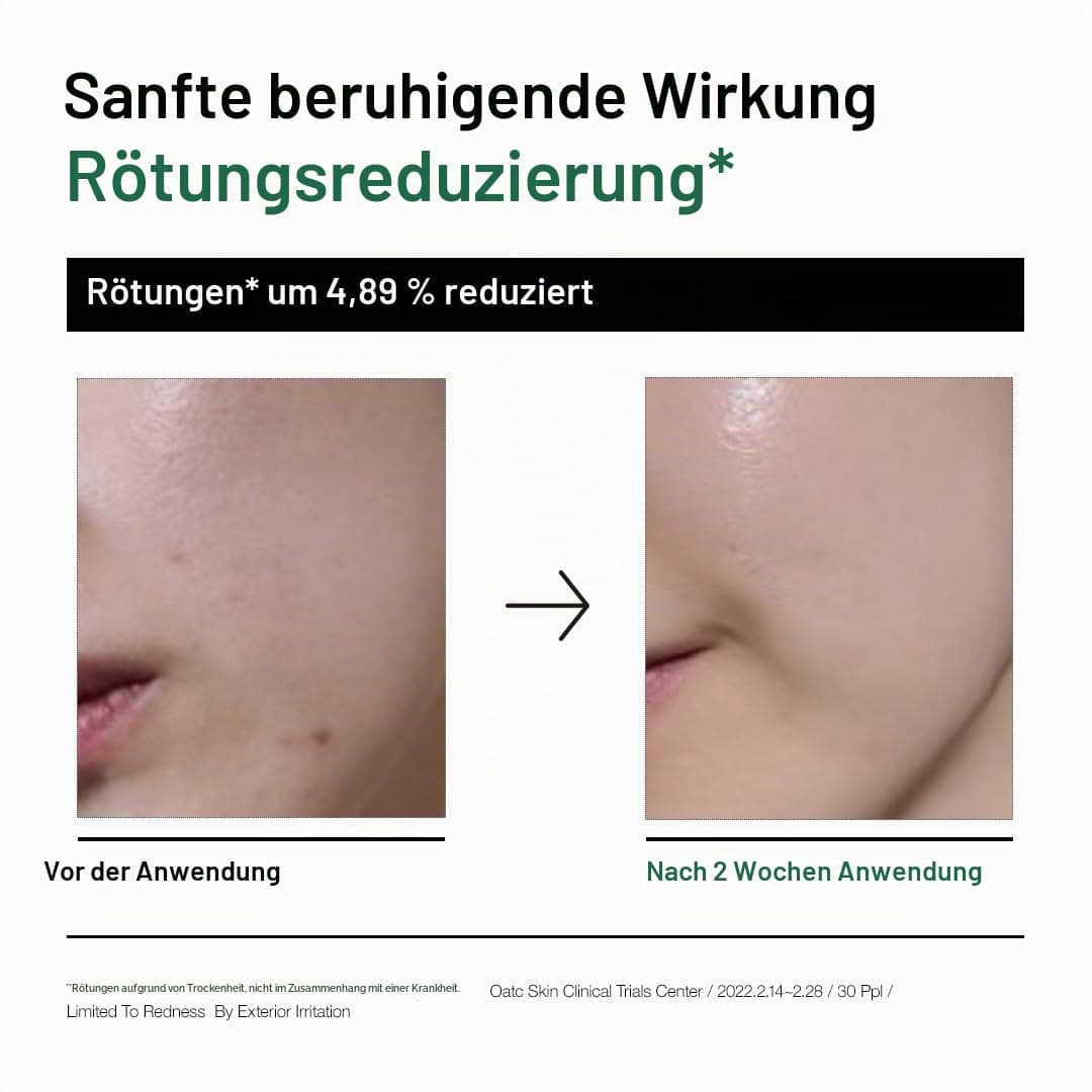ANUA Heartleaf 80% Moisture Soothing Ampoule (30 ml)