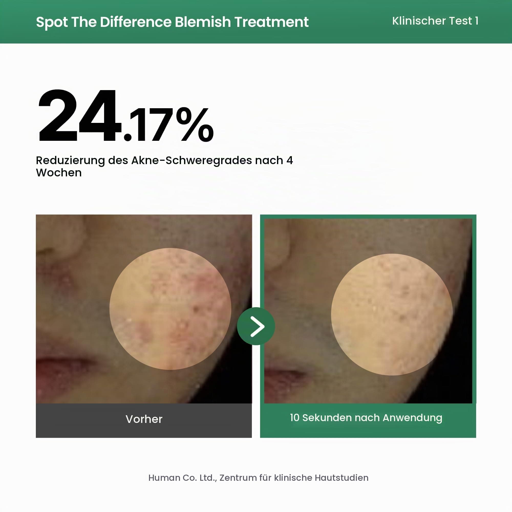 AXIS-Y Spot The Difference Blemish Spot Treatment 15ml