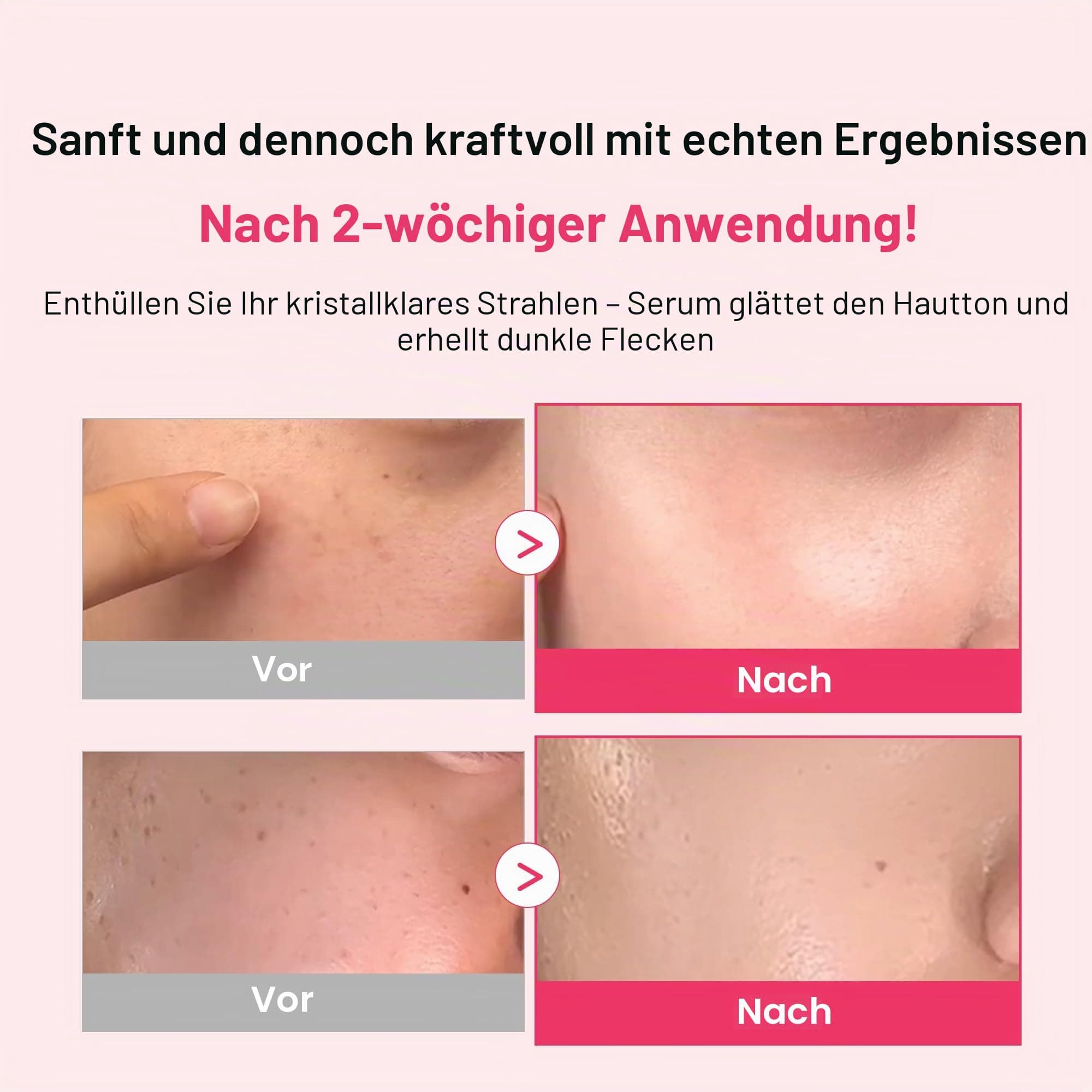 Redence Tone & Spot Ampoule Serum