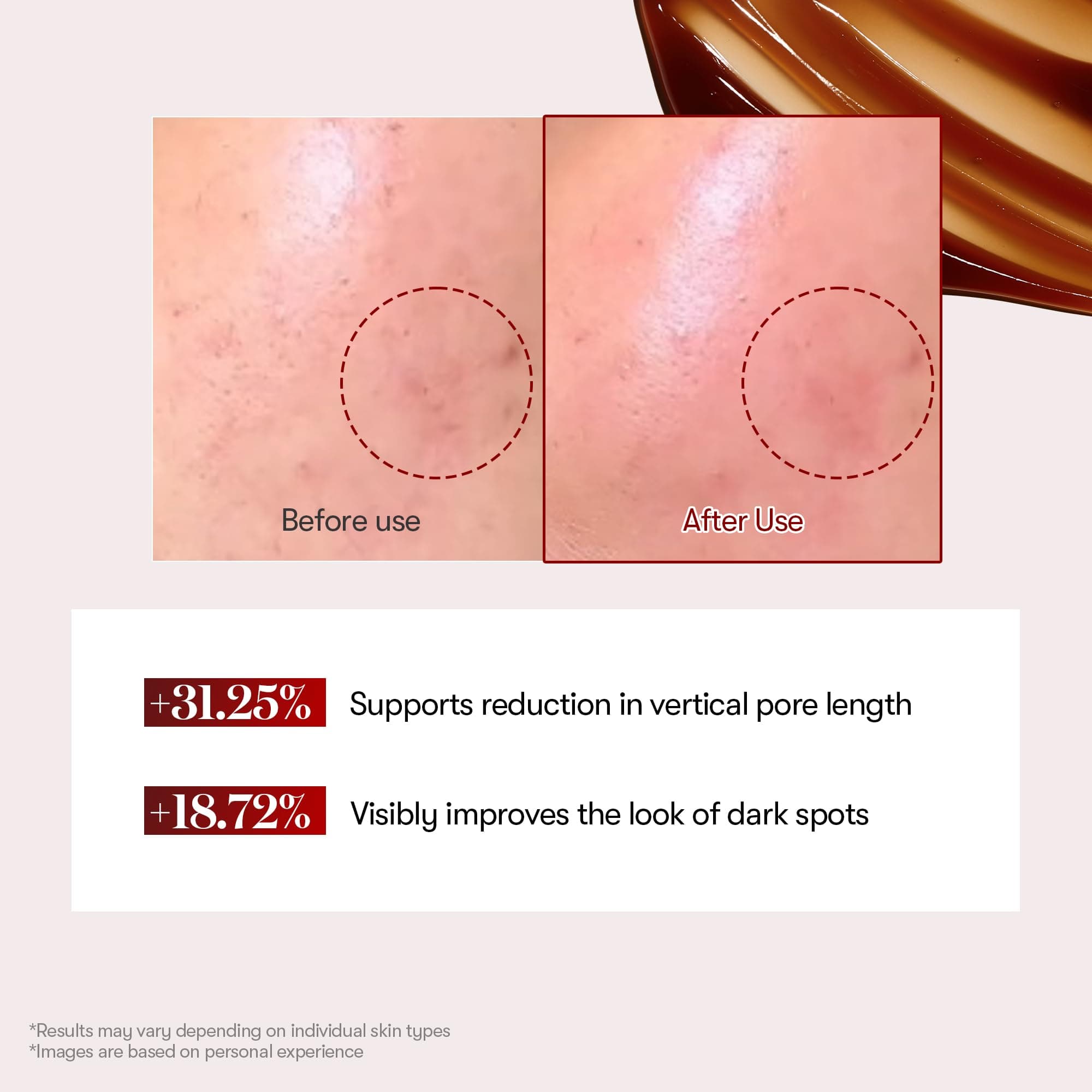 VT COSMETICS Red Booster Reedle Shot 100 Mikronadels-serums