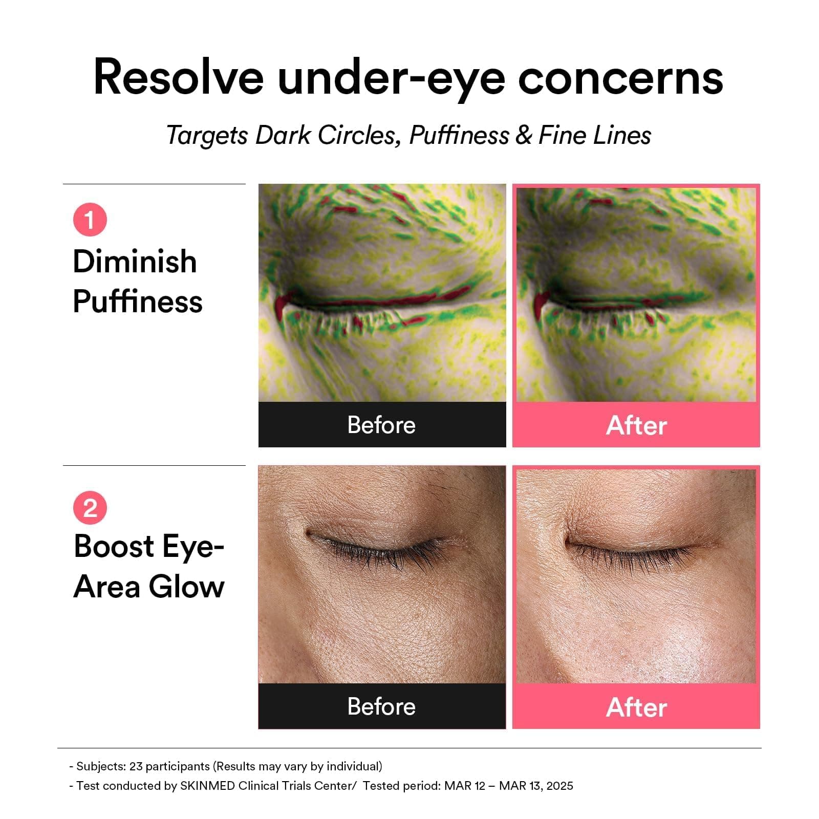 Abib PDRN Retinal Augenpatches für müde & geschwollene Augen mit Glow Jelly, Niacinamid, 60 Stück, Koreanische Hautpflege