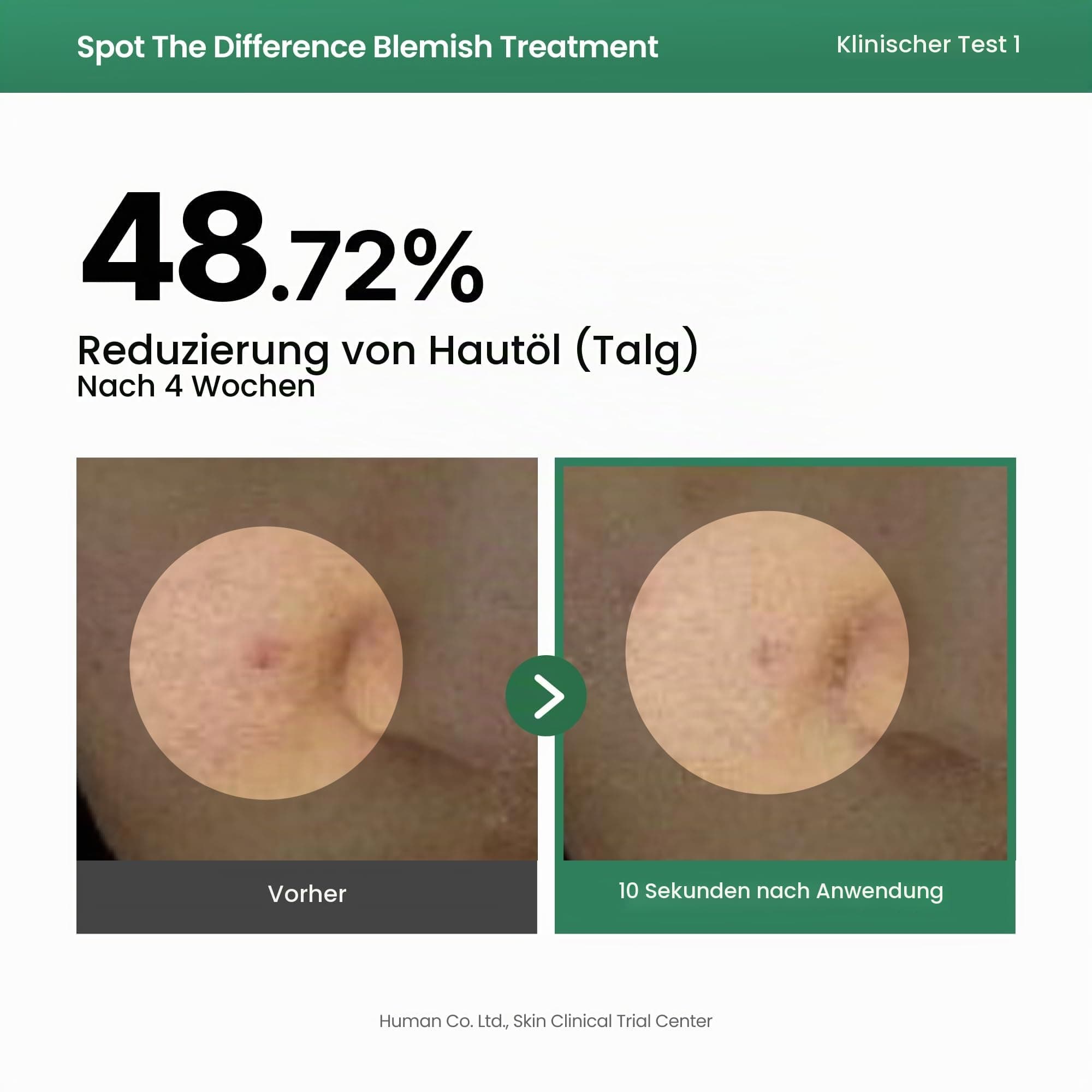 AXIS-Y Spot The Difference Blemish Spot Treatment 15ml