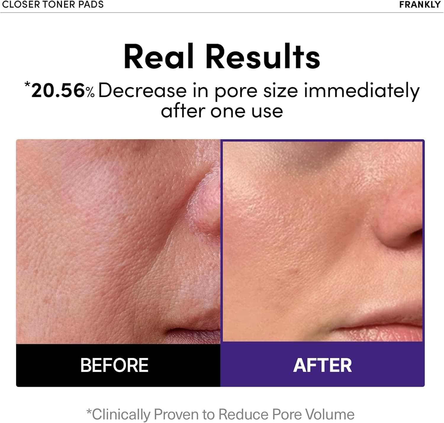 FRANKLY Pore Closer Tonerpads