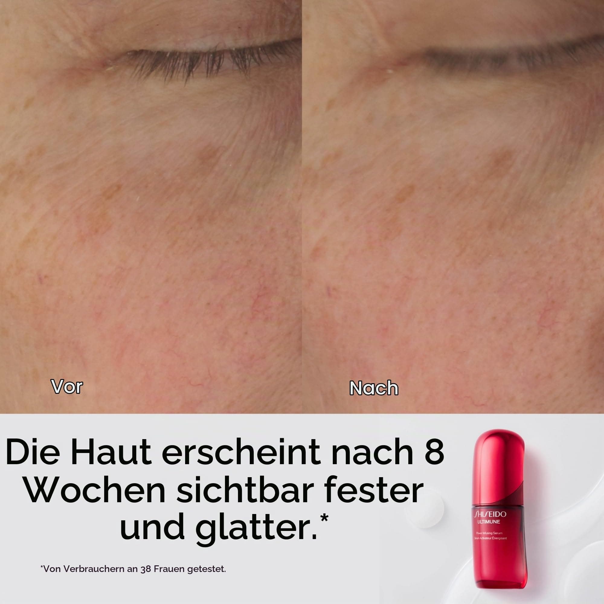 Shiseido Ultimune Future Power Infusing sejas serums