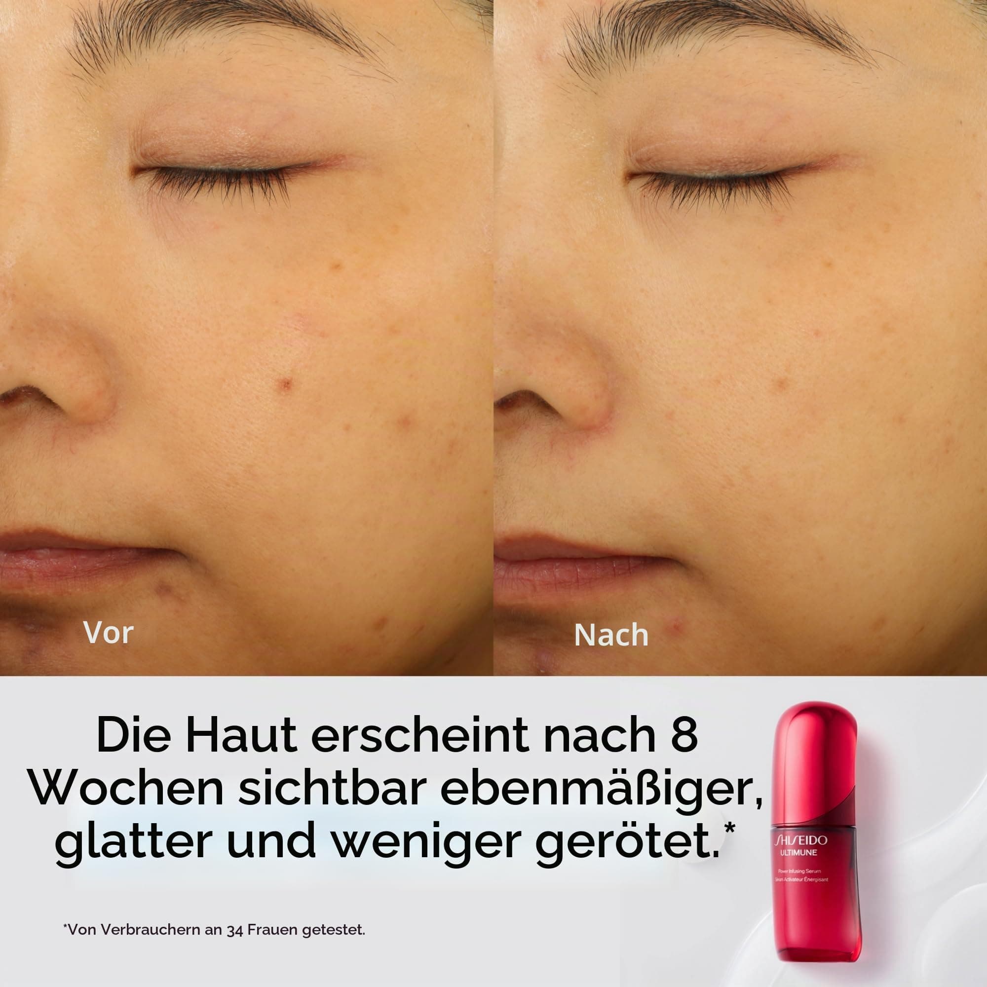 Shiseido Ultimune Future Power Infusing sejas serums
