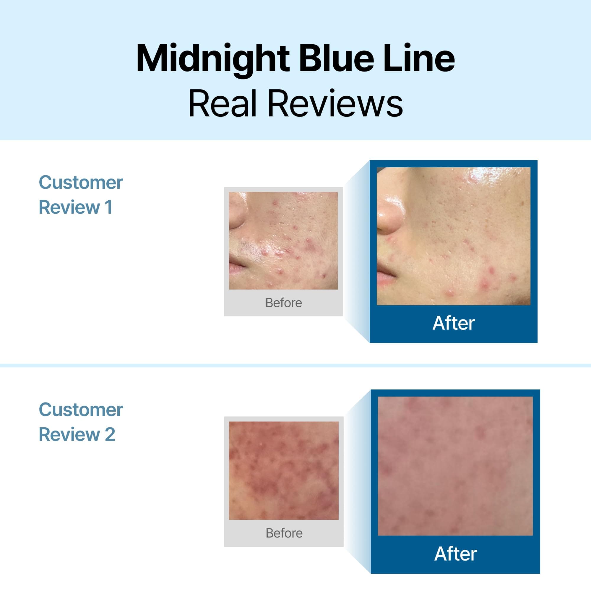 DearKlairs Mitternachtsblaue beruhigende Creme